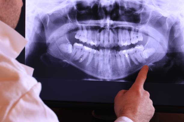 Best Emergency Root Canal Treatment in Danville, IA